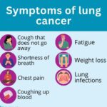 lung cancer - Lung Cancer Symptoms and Treatment