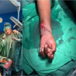 Holy Family Hospital Rawalpindi where doctors replanted the severed hand of a five-year-old child